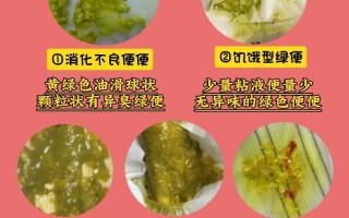 新生儿便便发绿是何原因？