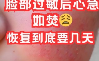 孕期脸过敏泛红怎么办？安全有效的护肤方法有哪些？