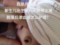 新生儿肚脐脱落后出血怎么办？