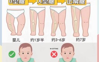 新生儿腿和脚向内弯曲是正常现象还是需要干预的异常情况？