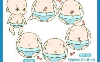 脐带脱落后，护理要注意什么？