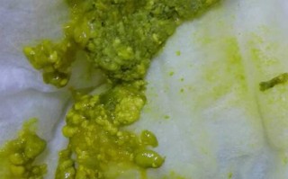 新生儿大便为何有粒粒状？