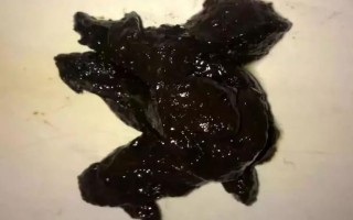 新生儿第一次大便黑色是正常现象还是健康警示？