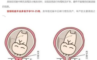 孕期宫颈长度短会影响胎儿吗？需要哪些保胎措施？