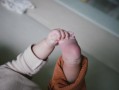 新生儿剪刀脚图片大全，剪刀脚是脑瘫信号吗？正常与异常区别在哪里？