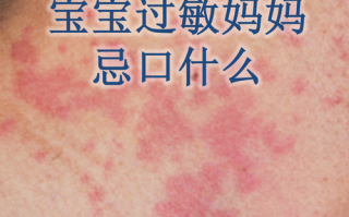 新生儿出现母乳蛋白过敏症状，妈妈饮食该如何调整才能继续哺乳？