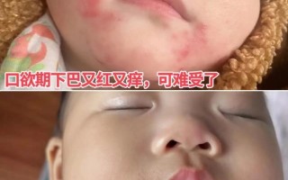 新生儿嘴周围发青怎么回事