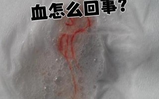 孕期鼻子和喉咙总出血，是正常生理反应还是危险信号？