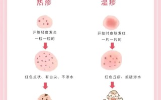 新生儿脸上热出的湿疹怎么护理才能好得快？