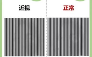 儿童弱视和近视有何本质区别？成因、危害及干预措施有何不同？