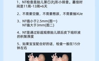 孕期NT检查究竟查什么？