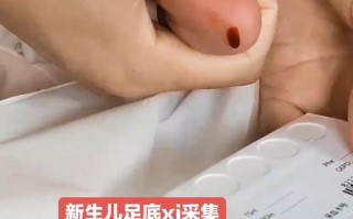 新生儿抽足底血到底是在检查哪些疾病呢？这些检查对宝宝健康有多重要？