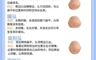 新生儿头尖尖的怎么办