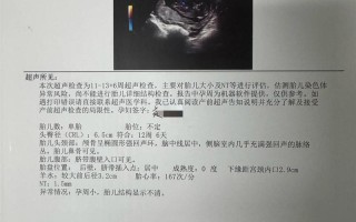 孕期三个月后，每次产检都查哪些项目？这些检查对胎儿和孕妇有多重要？