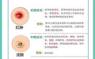 新生儿肚脐长脓是感染了吗？该如何正确处理和护理？