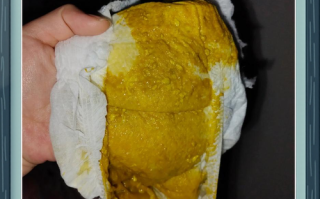 新生儿三天没大便，是攒肚还是便秘？需要干预吗？