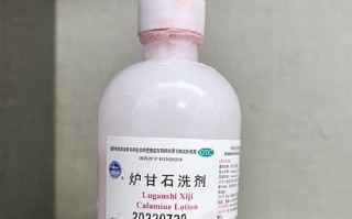 孕期湿疹可以喝中药吗