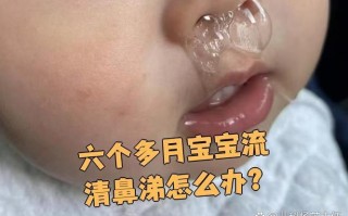 新生儿鼻子有鼻涕但不会擤鼻涕，家长该如何正确处理和护理？