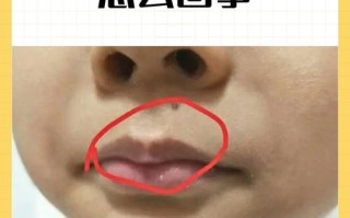 新生儿嘴唇发白是缺氧还是贫血？新手爸妈该如何应对？