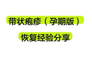 孕期带状疱疹怎么治？