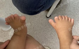 新生儿睡觉脚总是弯曲，是正常生理现象还是需要干预的信号？