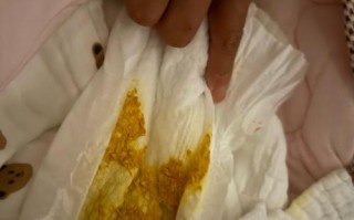 新生儿拉屎有酸臭味是正常现象还是消化异常信号？