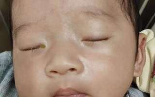 新生儿眼睛流泪又长眼屎，是正常还是生病了？