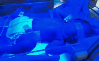 新生儿黄疸照蓝光八天还没退，到底正常吗？需要继续照还是该换方案？