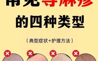 儿童荨麻疹频发，究竟哪些隐形推手在悄悄作祟？