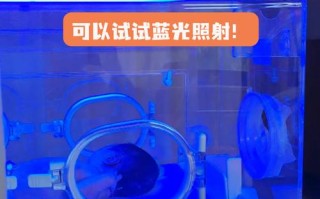 新生儿黄疸值多少必须照蓝光？