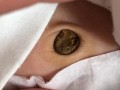 新生儿脐带未脱落且发白是正常现象还是异常信号？