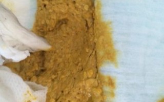 新生儿宝宝5天没大便，是攒肚还是便秘？需要立即就医吗？