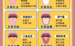 新生儿舌苔发白是正常现象还是健康预警？需要关注哪些潜在问题？