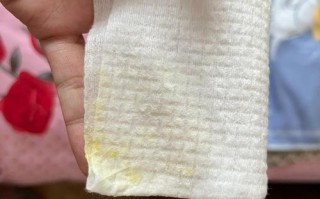 新生儿吐透明粘稠液体