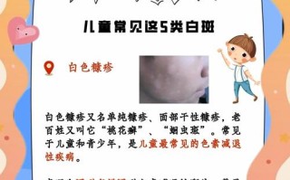 新生儿皮肤白是遗传吗