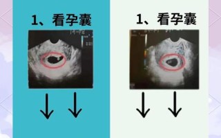 怀孕期间怎样分辨男女