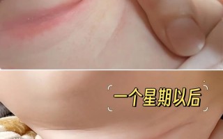 新生儿全身抖动是怎么回事