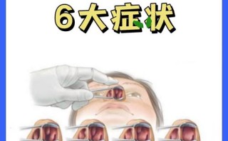 儿童下鼻甲肥大到底该如何科学处理？