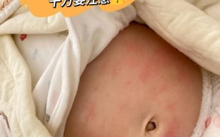 新生儿热敷肚子多少度才合适？温度过高会烫伤宝宝吗？