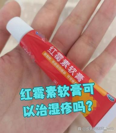 新生儿湿疹能用红霉素软膏吗？-第2张图片-郑州医学网