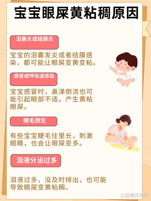 新生儿黄疸眼珠发黄怎么处理？-第1张图片-郑州医学网