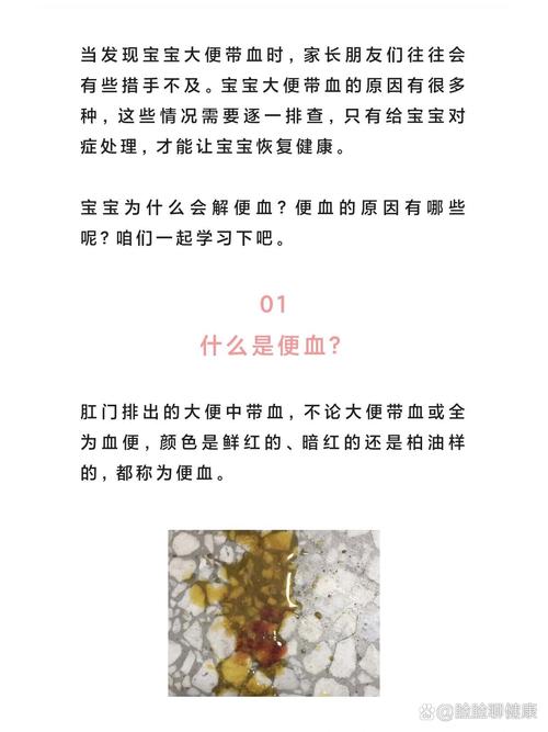新生儿大便潜血，啥原因？-第1张图片-郑州医学网