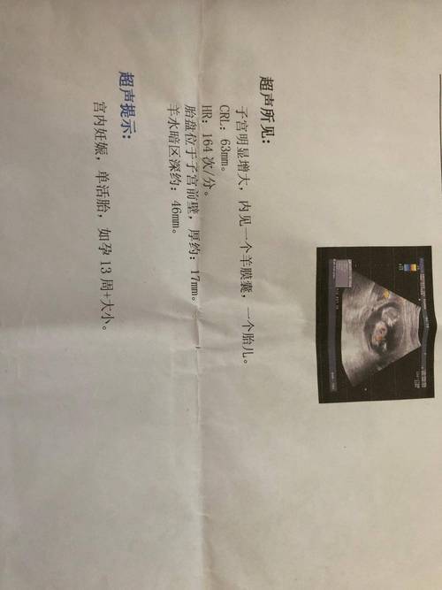 孕期B超最多能做几次?-第3张图片-郑州医学网 孕期B超最多能做几次?-第3张图片-郑州医学网