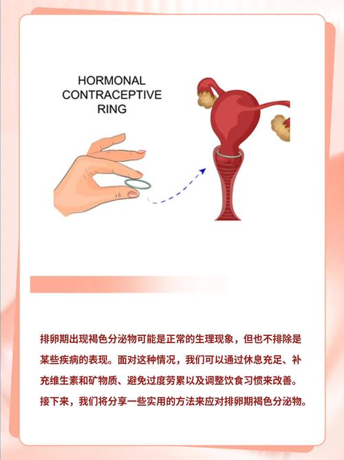 孕期同房后现褐色分泌物，是危险信号吗？-第3张图片-郑州医学网