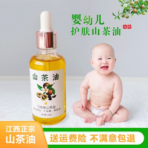 新生儿长湿疹能涂茶油吗？-第3张图片-郑州医学网