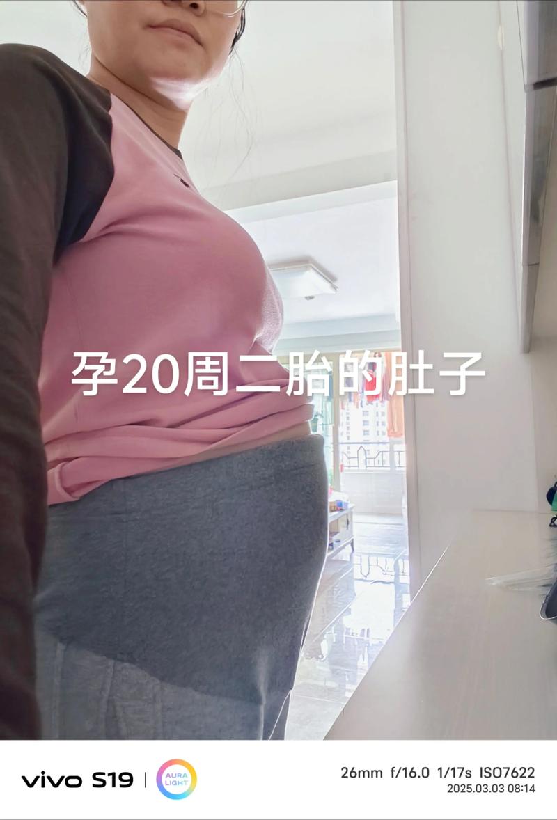 孕期仅涨10斤正常吗？-第2张图片-郑州医学网