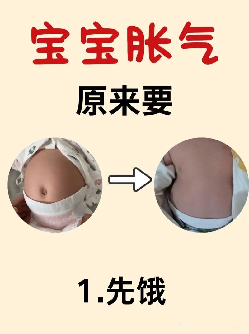 新生儿肚子胀气有哪些典型症状？-第1张图片-郑州医学网