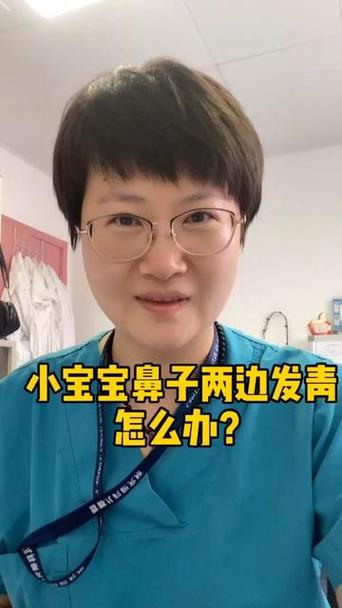 新生儿鼻子嘴巴周围发青是缺氧吗？-第2张图片-郑州医学网