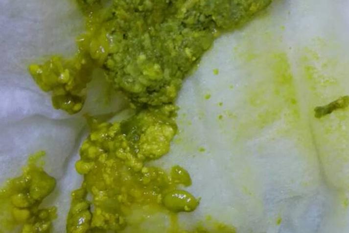 新生儿大便为何有粒粒状?-第1张图片-郑州医学网 新生儿大便为何有粒粒状?-第1张图片-郑州医学网