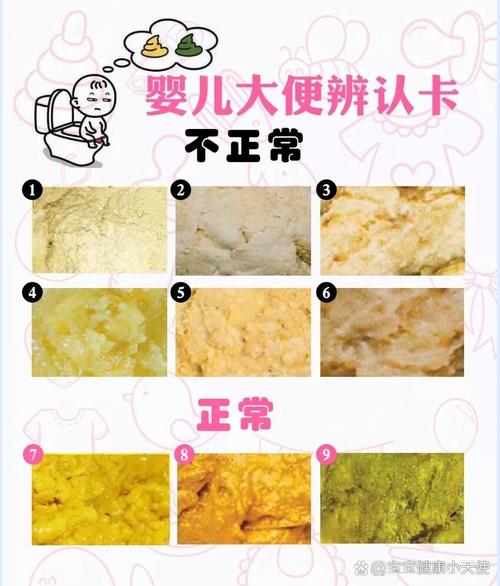 新生儿每日一次大便是否正常？-第3张图片-郑州医学网